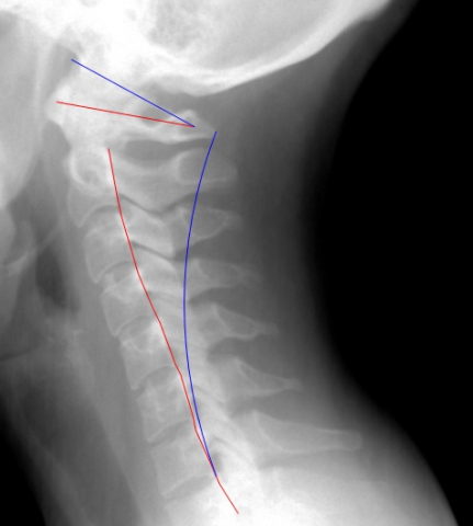 side-view of my neck